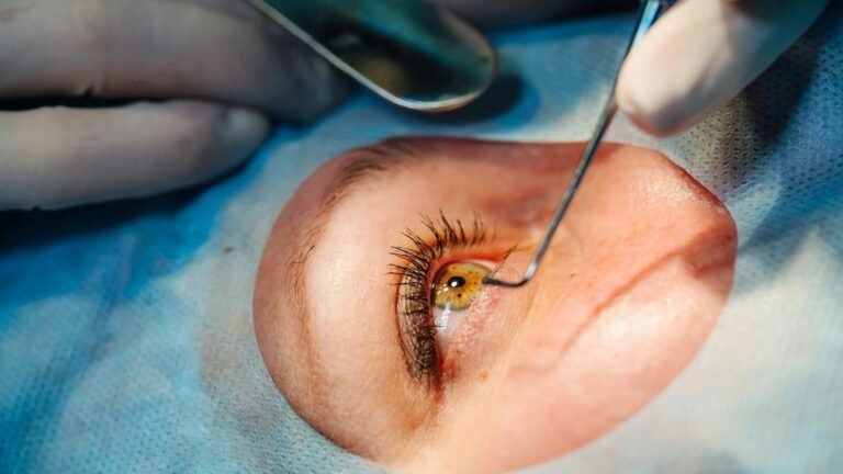 Laser Eye Surgery in Melbourne: How the Treatment Process Works Laser Eye Surgery in Melbourne: How the Treatment Process Works